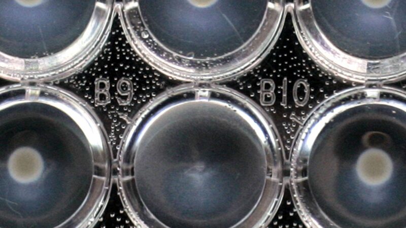 E. coli : le nombre de cas de contamination double en France