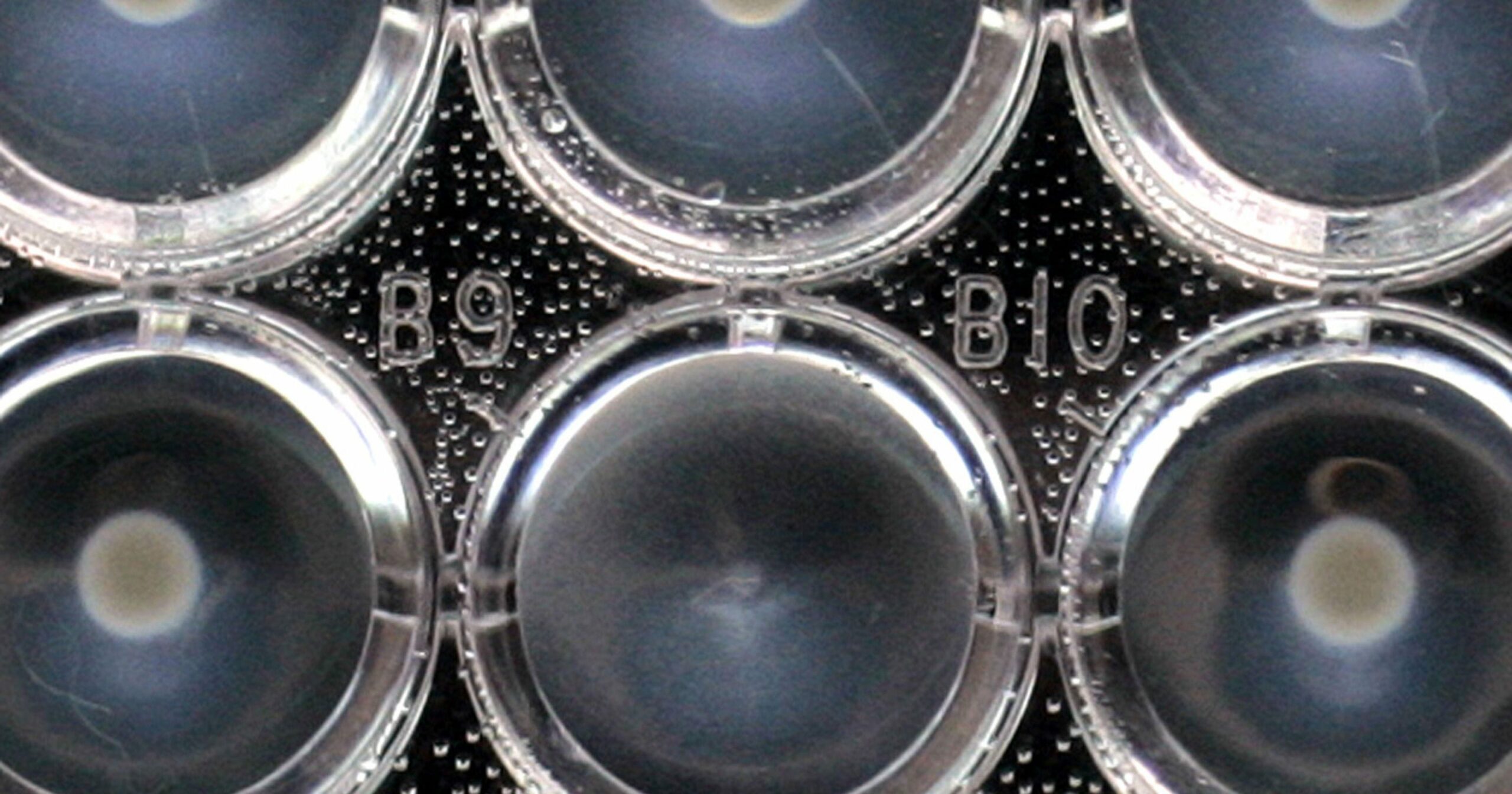 E. coli : le nombre de cas de contamination double en France