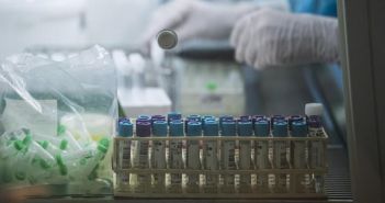 La France confirme un premier cas issu de la nouvelle souche de coronavirus